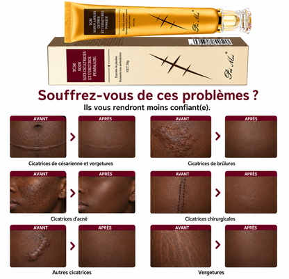 Crème Réparatrice Anti-Cicatrices & VERGETURES